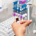 Điện tích của protein cũng ảnh hưởng đáng kể đến độ hòa tan